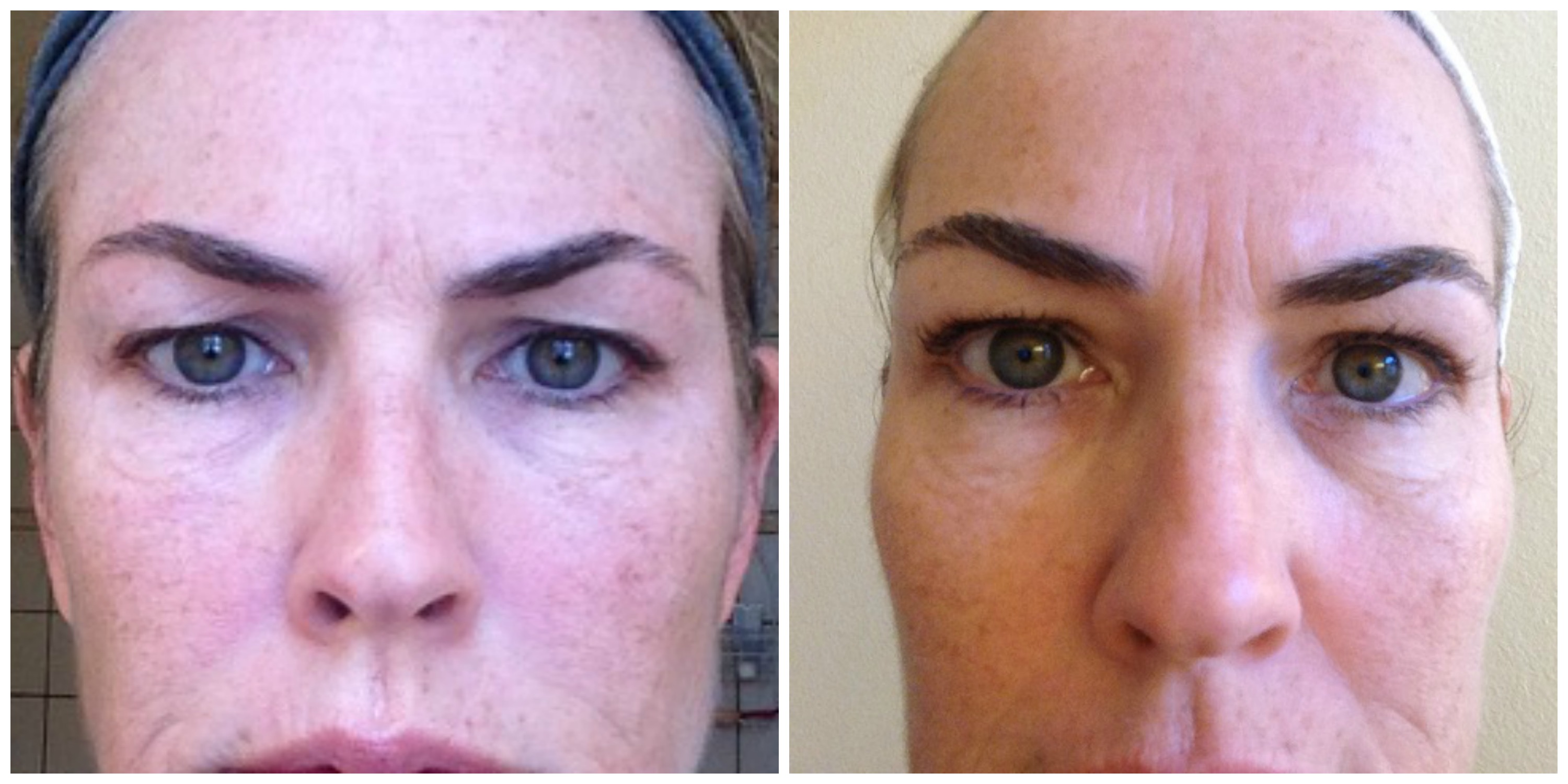 EVER Skincare 30 Day Challenge Results - Agoura Hills Mom